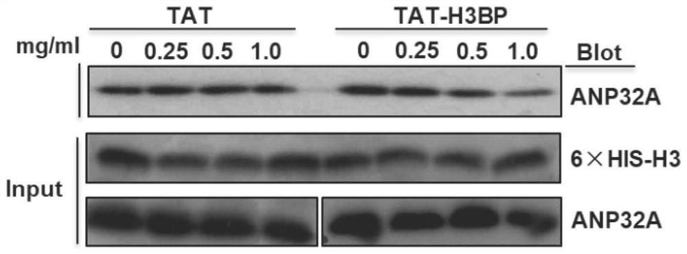 ANP32A-targeted anti-leukemia small molecule peptide as well as preparation method and application thereof
