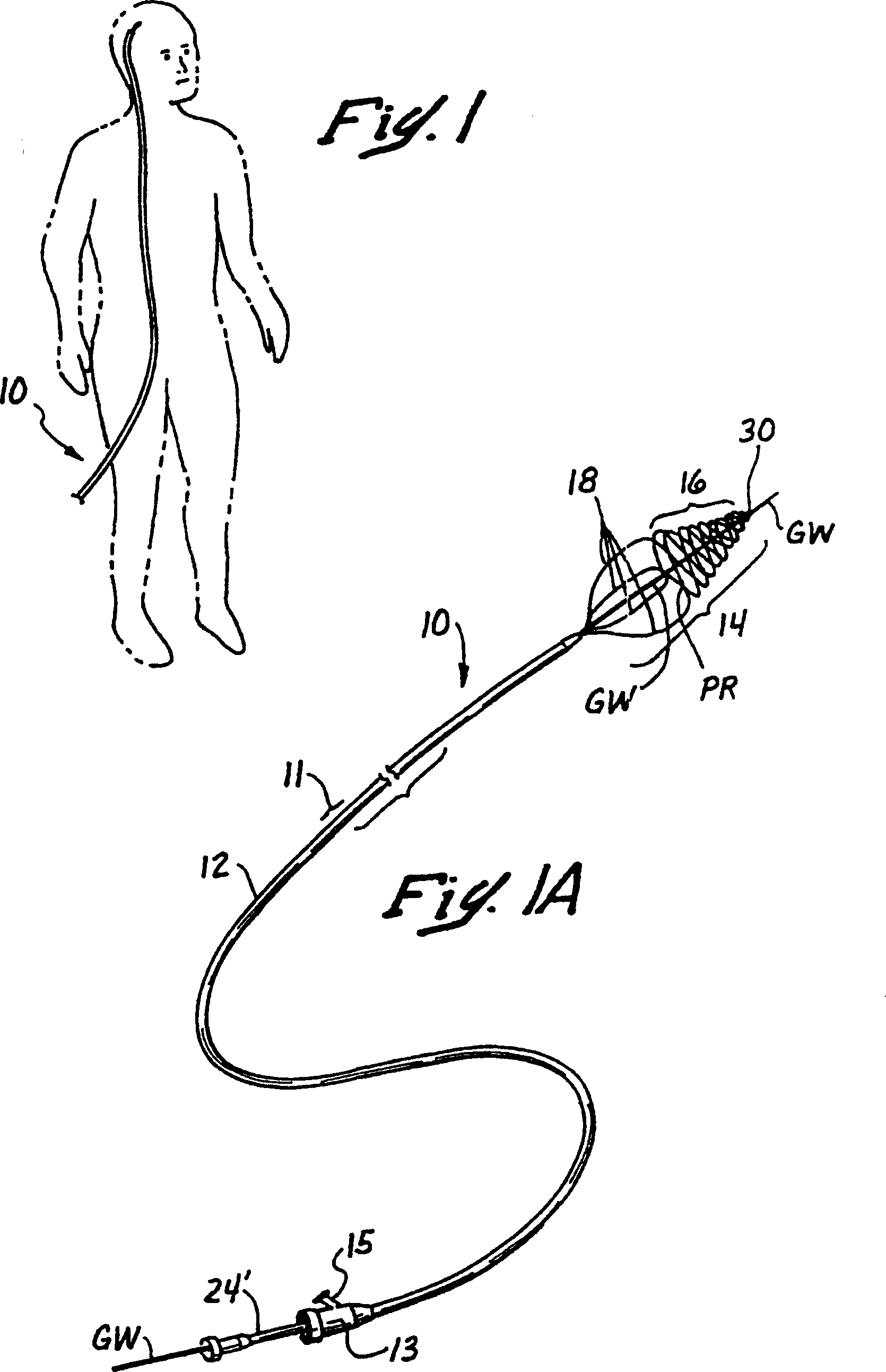 Embolectomy catheters and method for treatment