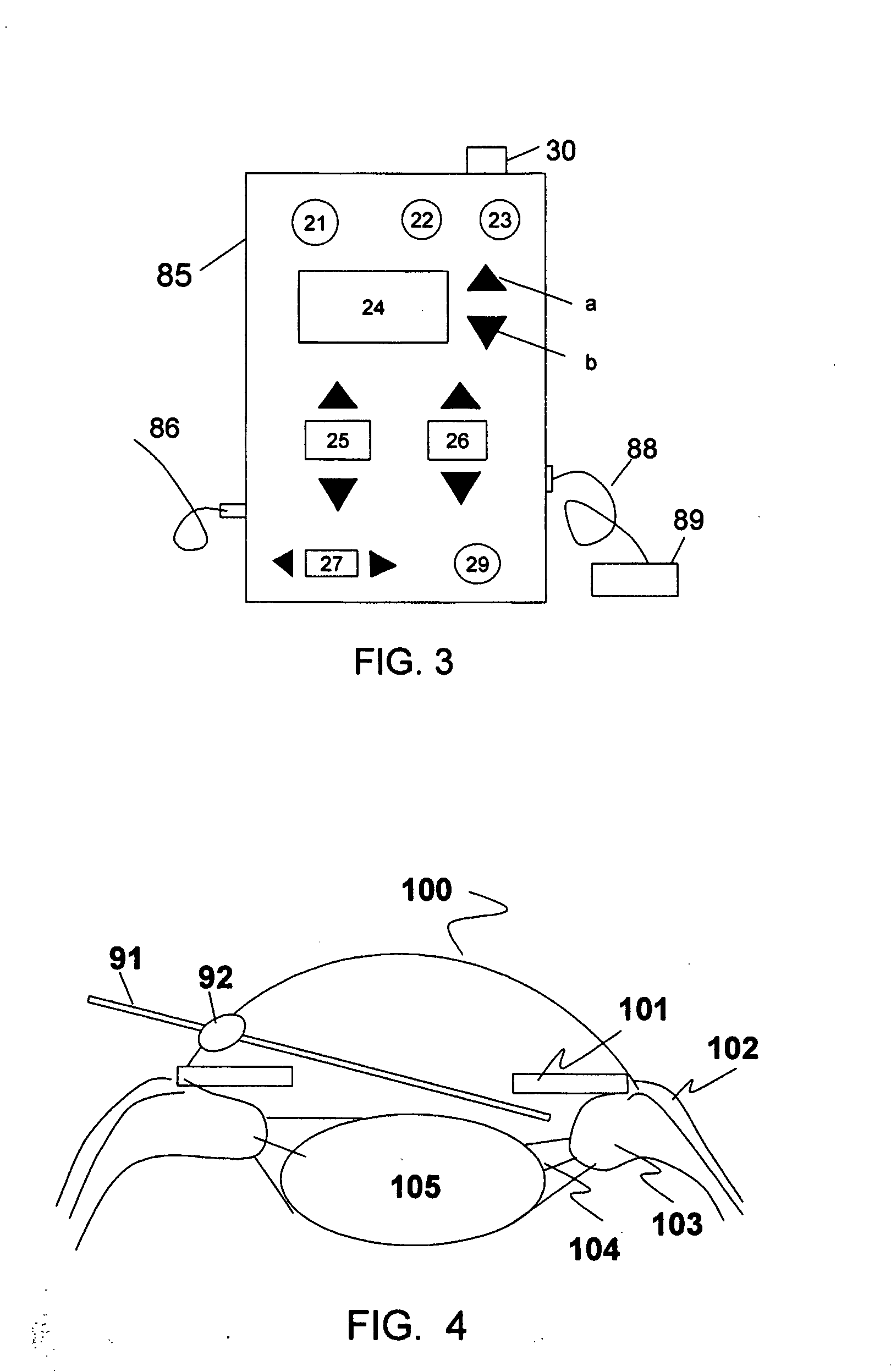 Method and system for endoscope-assisted non-invasive laser treatment of presbyopia