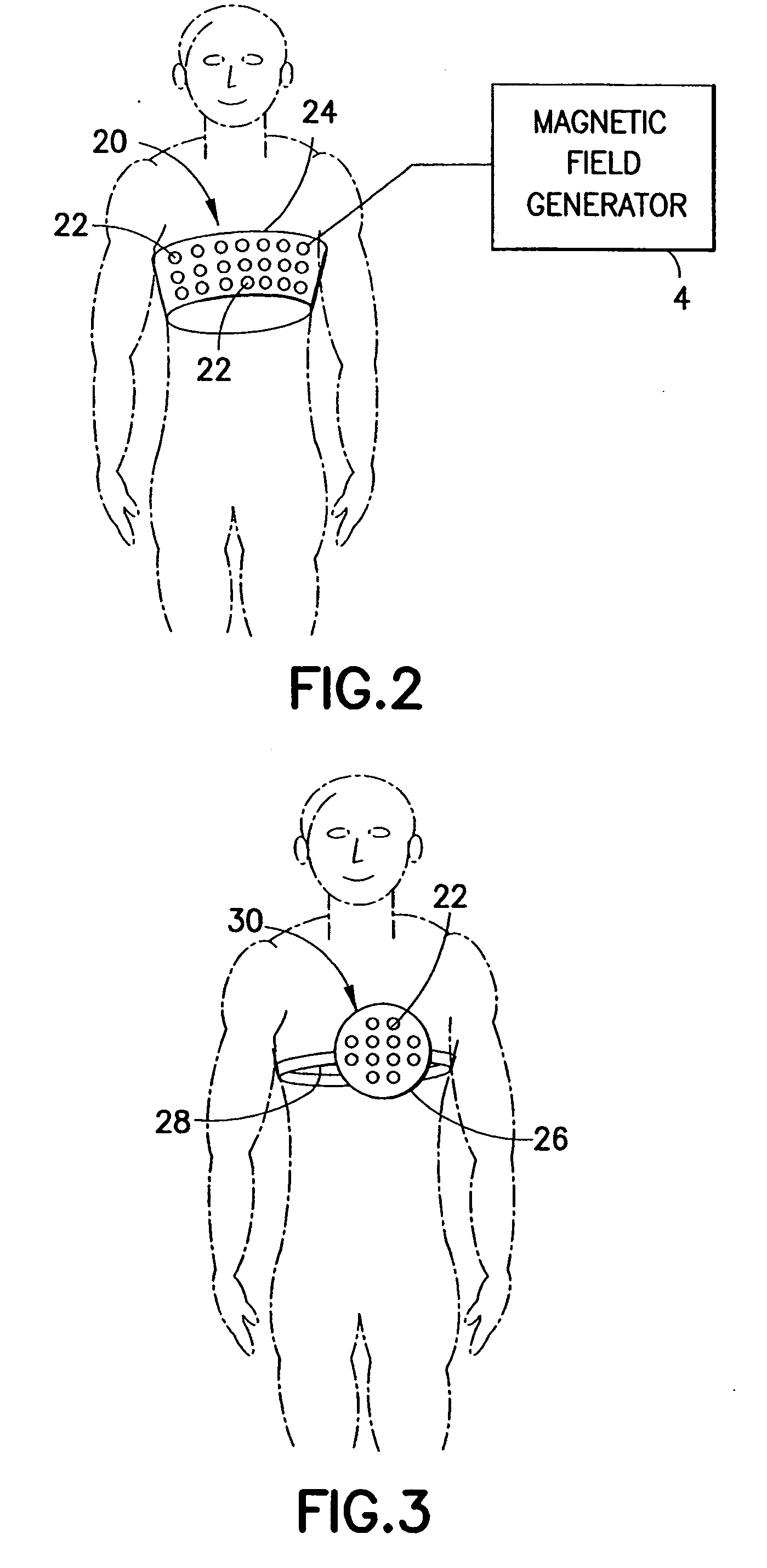 Method and apparatus for non-invasive therapy of cardiovascular ailments using weak pulsed electromagnetic radiation