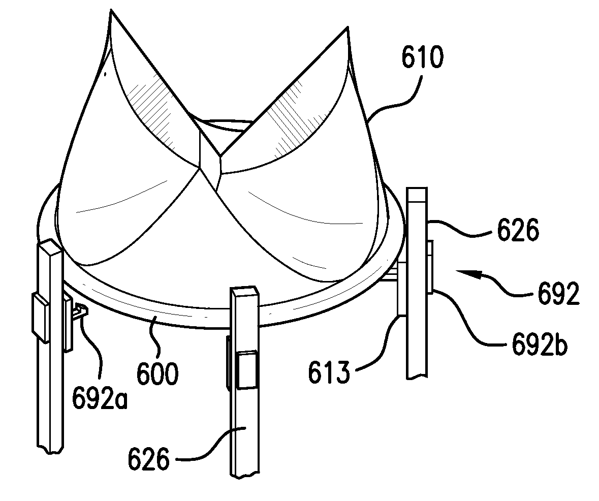 Modular percutaneous valve structure and delivery method