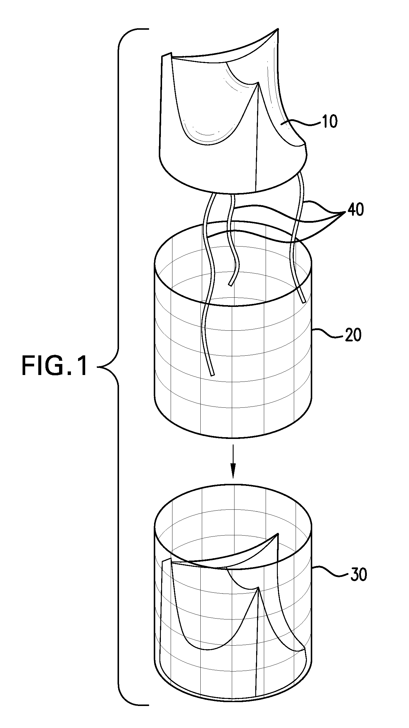 Modular percutaneous valve structure and delivery method
