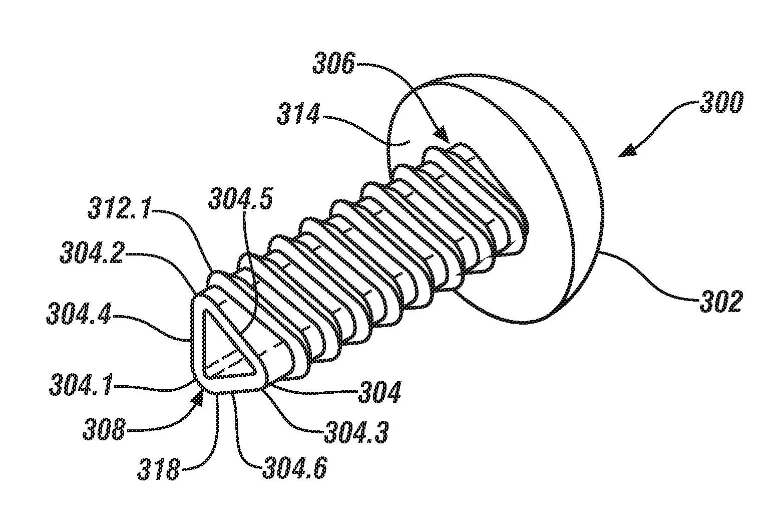 Elastically deformable alignment fastener and system