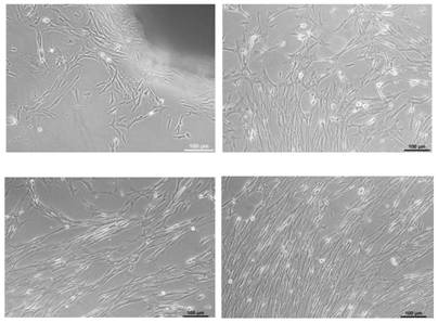 A method for culturing, identifying and inducing differentiation of Scorpius myoblasts in vitro