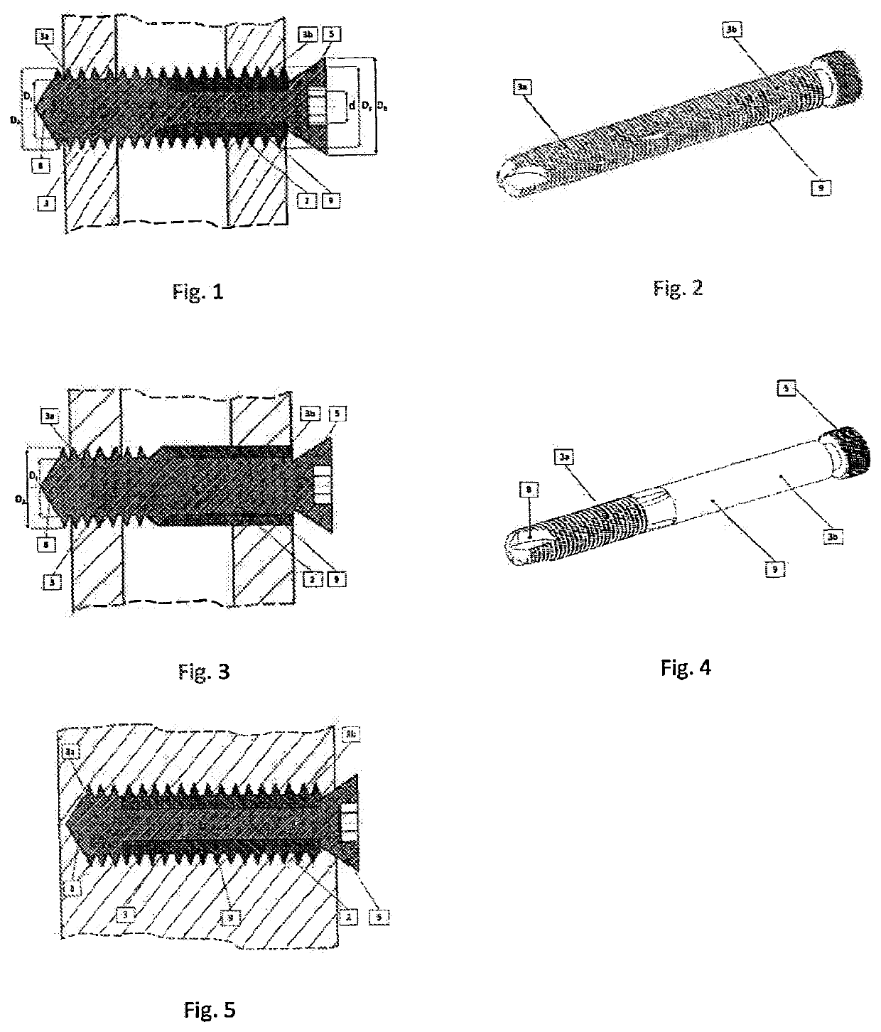 Device for variable fixation of bone fragments