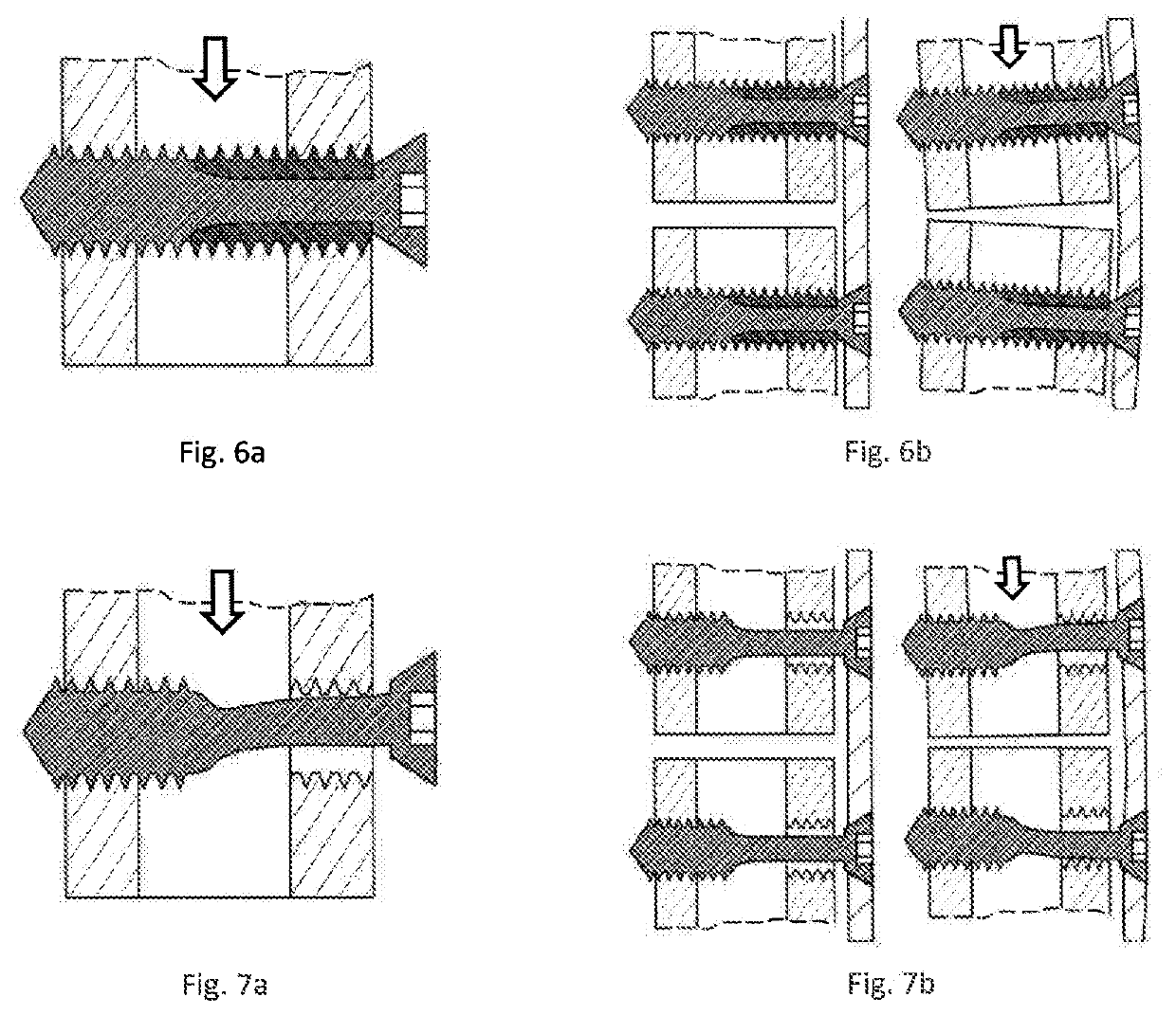 Device for variable fixation of bone fragments