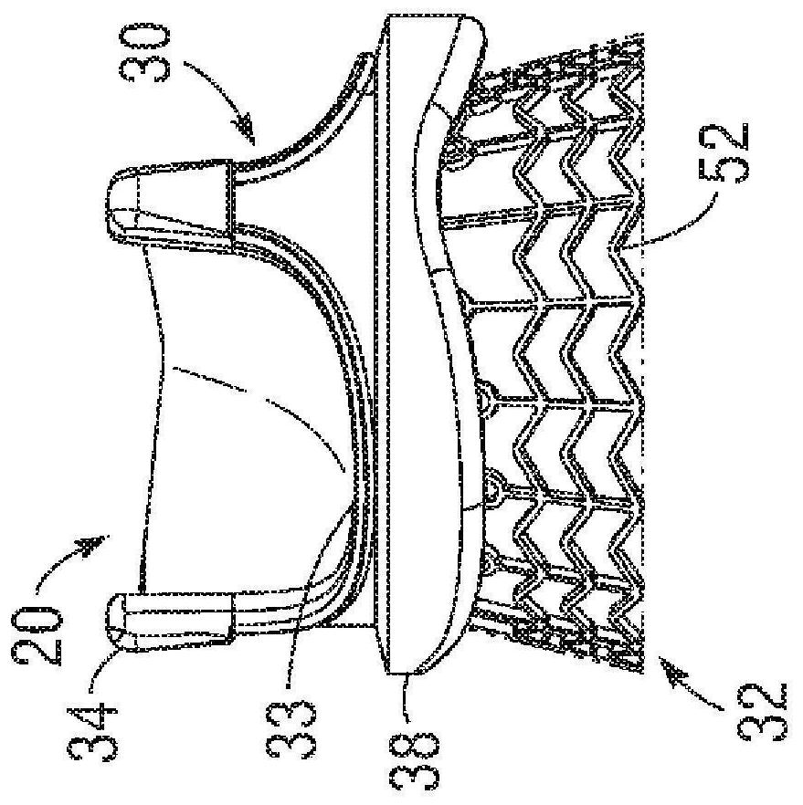 Heart valve deployment assist device