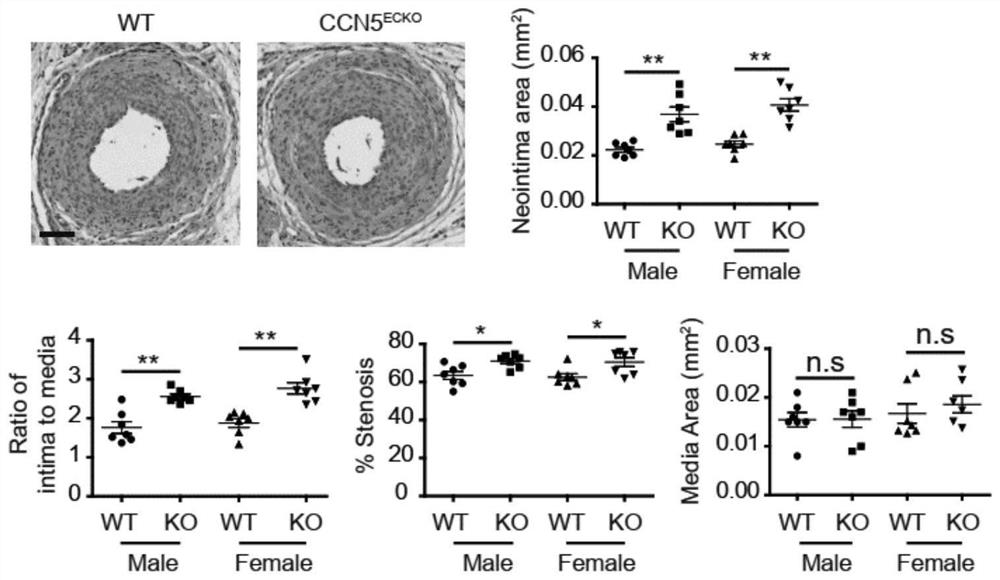 Stromal cell protein CCN5 composition and application thereof