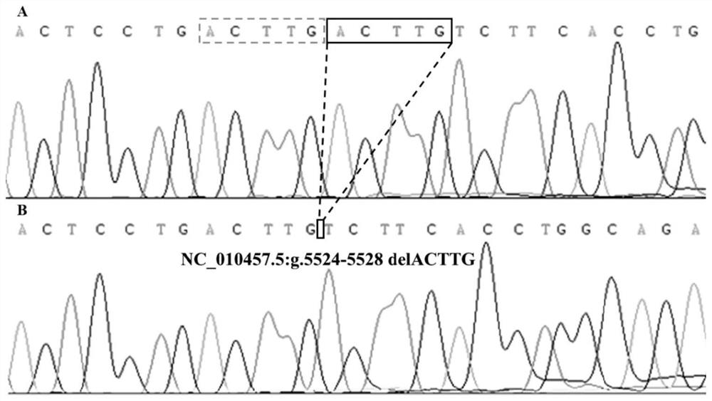 A detection method and application of boar star gene 5-bp repeat deletion polymorphism