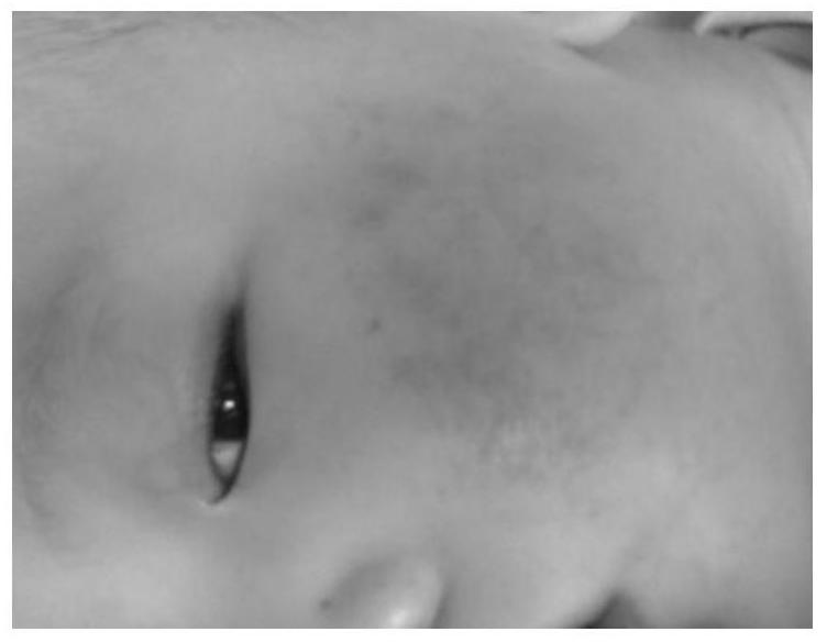 A composition for sensitive skin care of infants and its preparation method