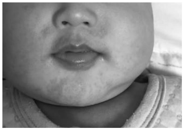 A composition for sensitive skin care of infants and its preparation method