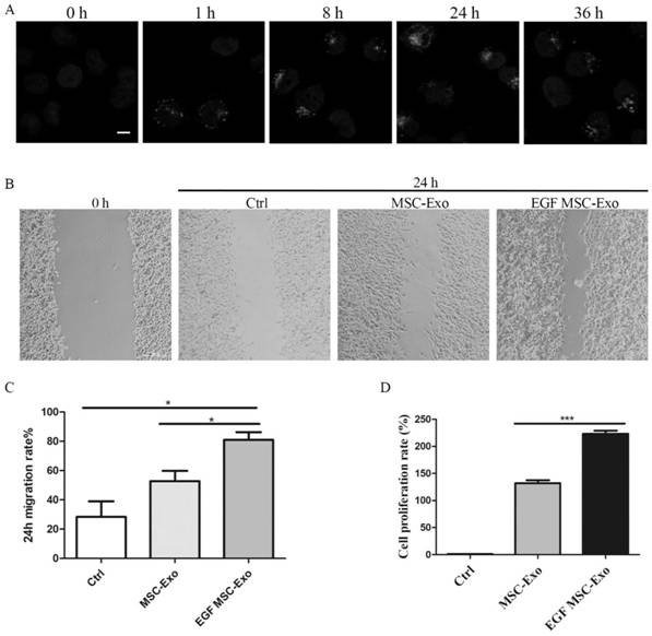 EGF mesenchymal stem cell exosome as well as preparation method and application thereof