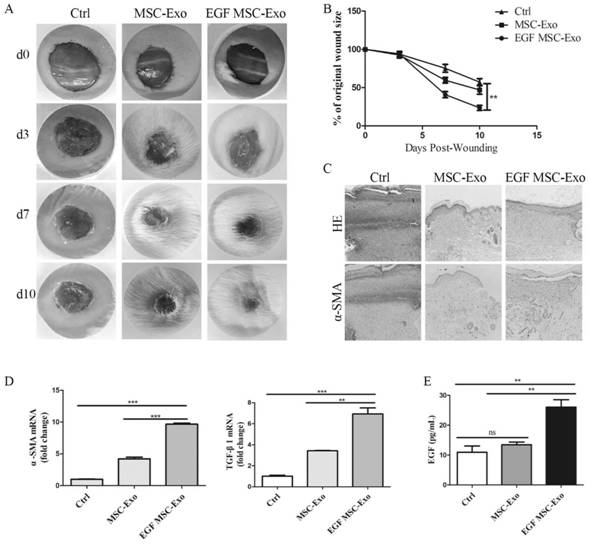 EGF mesenchymal stem cell exosome as well as preparation method and application thereof
