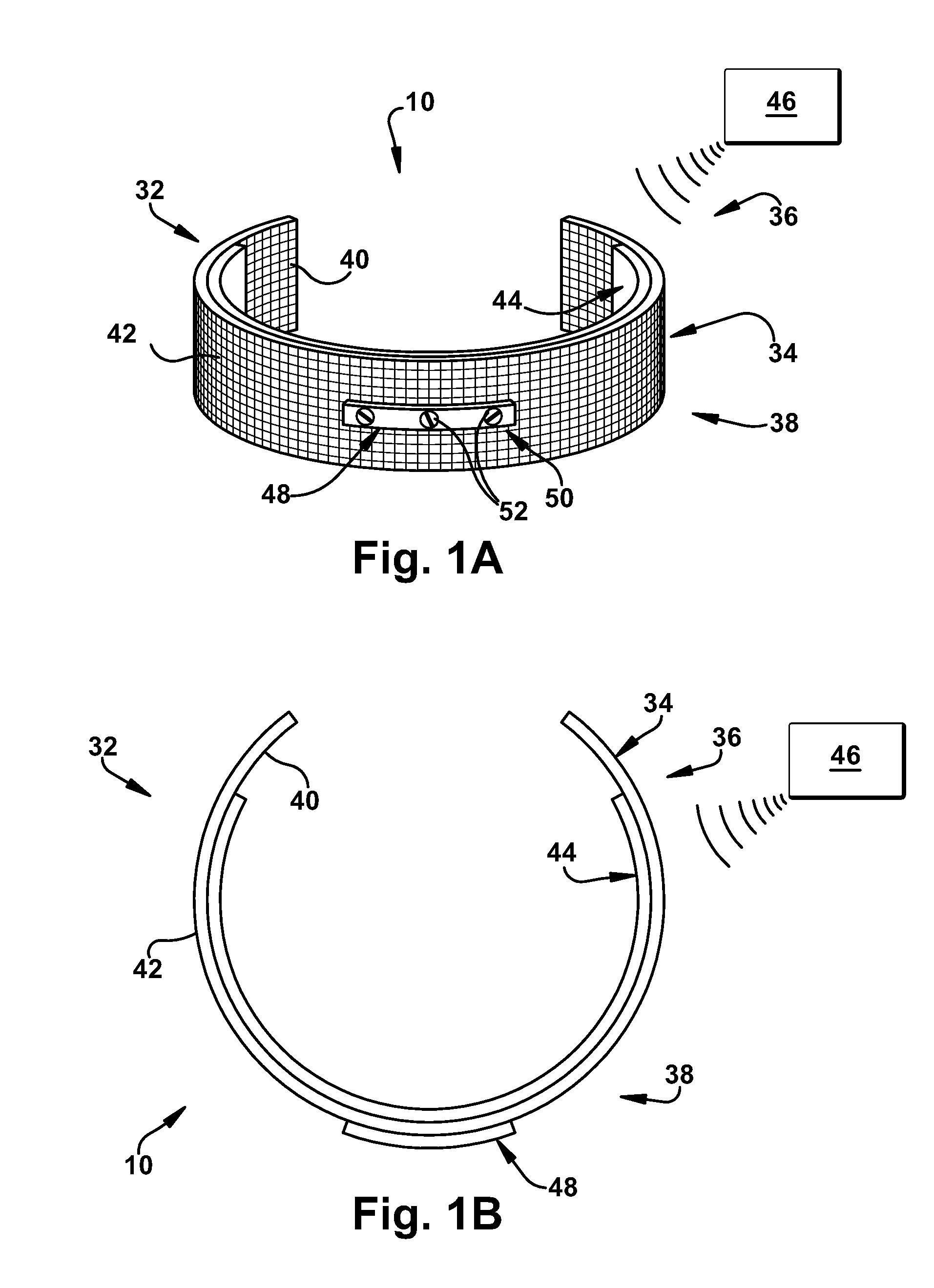 Apparatus and methods for treating pulmonary conditions