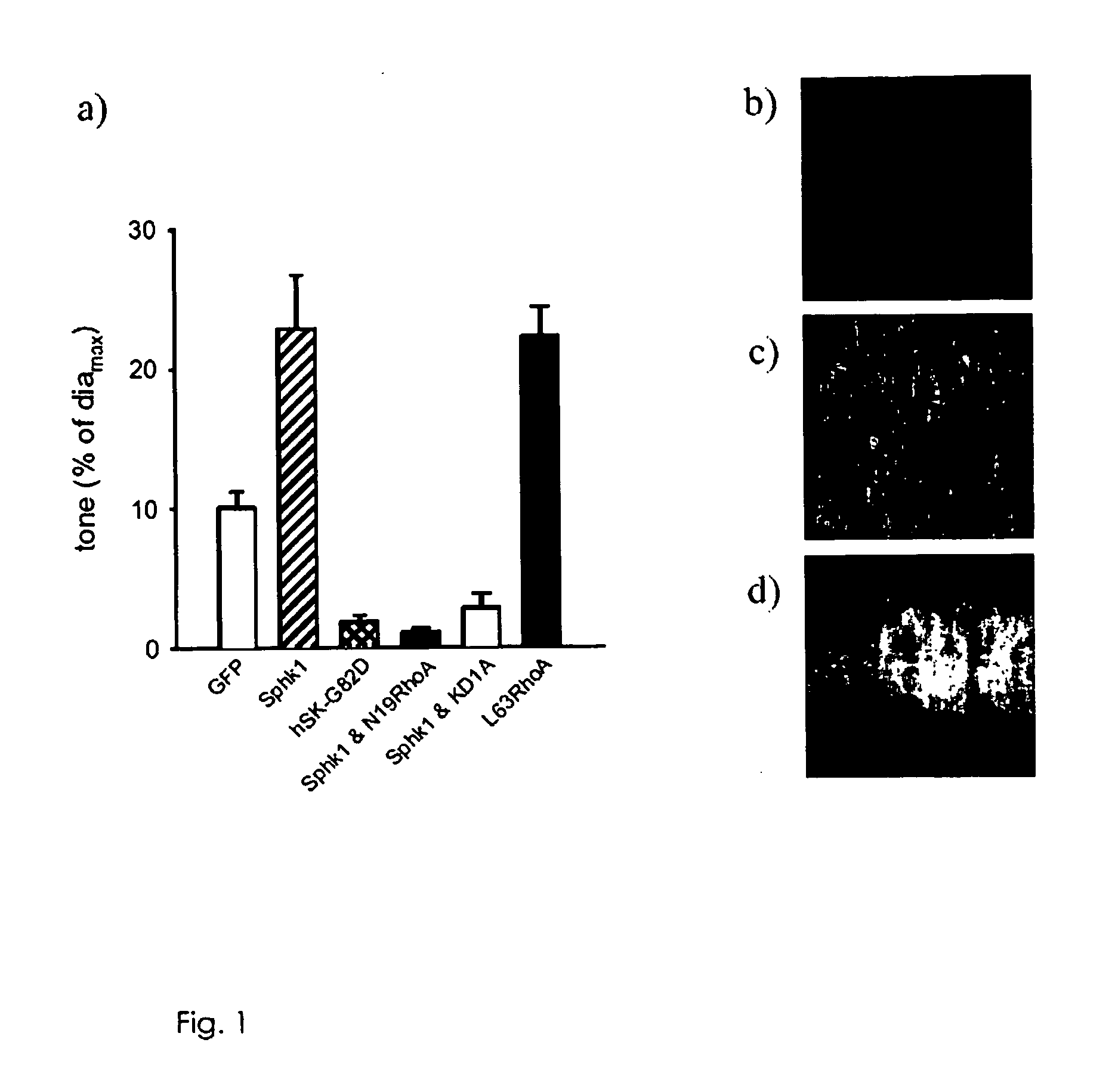 Method of modulating smooth muscle cell functioning by modulating sphingosine kinase mediated signalling