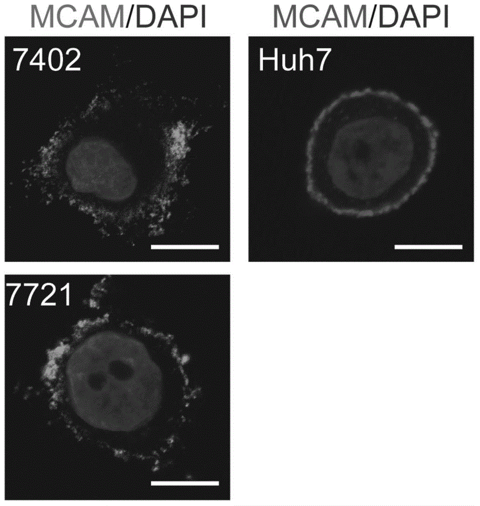 Hepatocarcinoma marker melanoma cell-adhesion molecule and application thereof