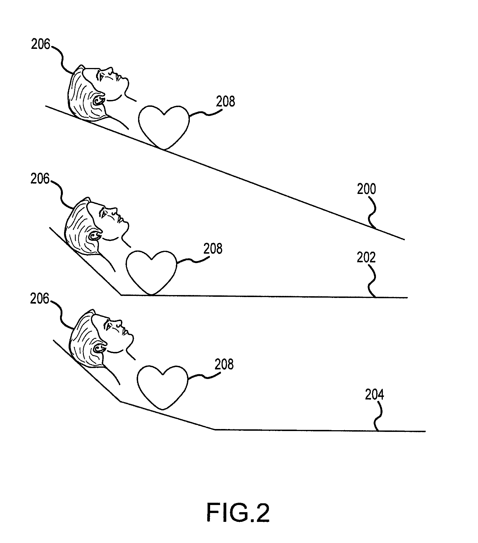 Active compression decompression and upper body elevation system