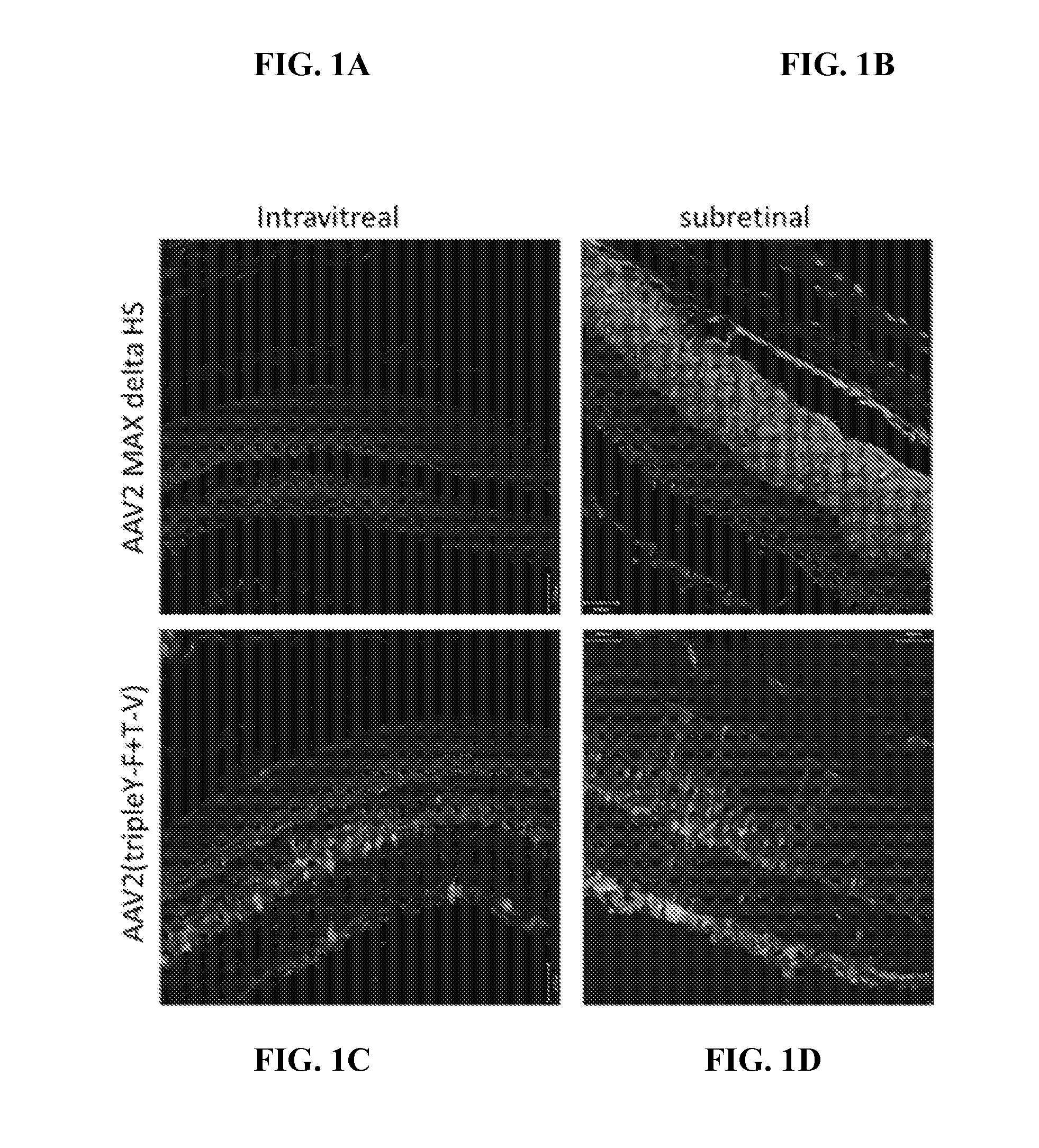 Improved raav vectors and methods for transduction of photoreceptors and rpe cells
