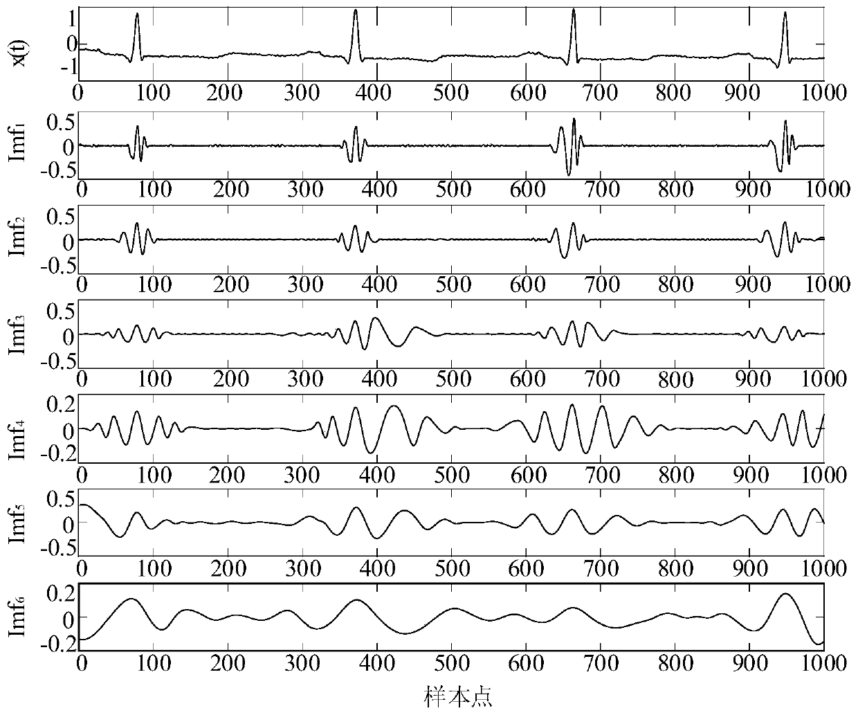 Feature extraction and classification method for automatically extracted electrocardio beats