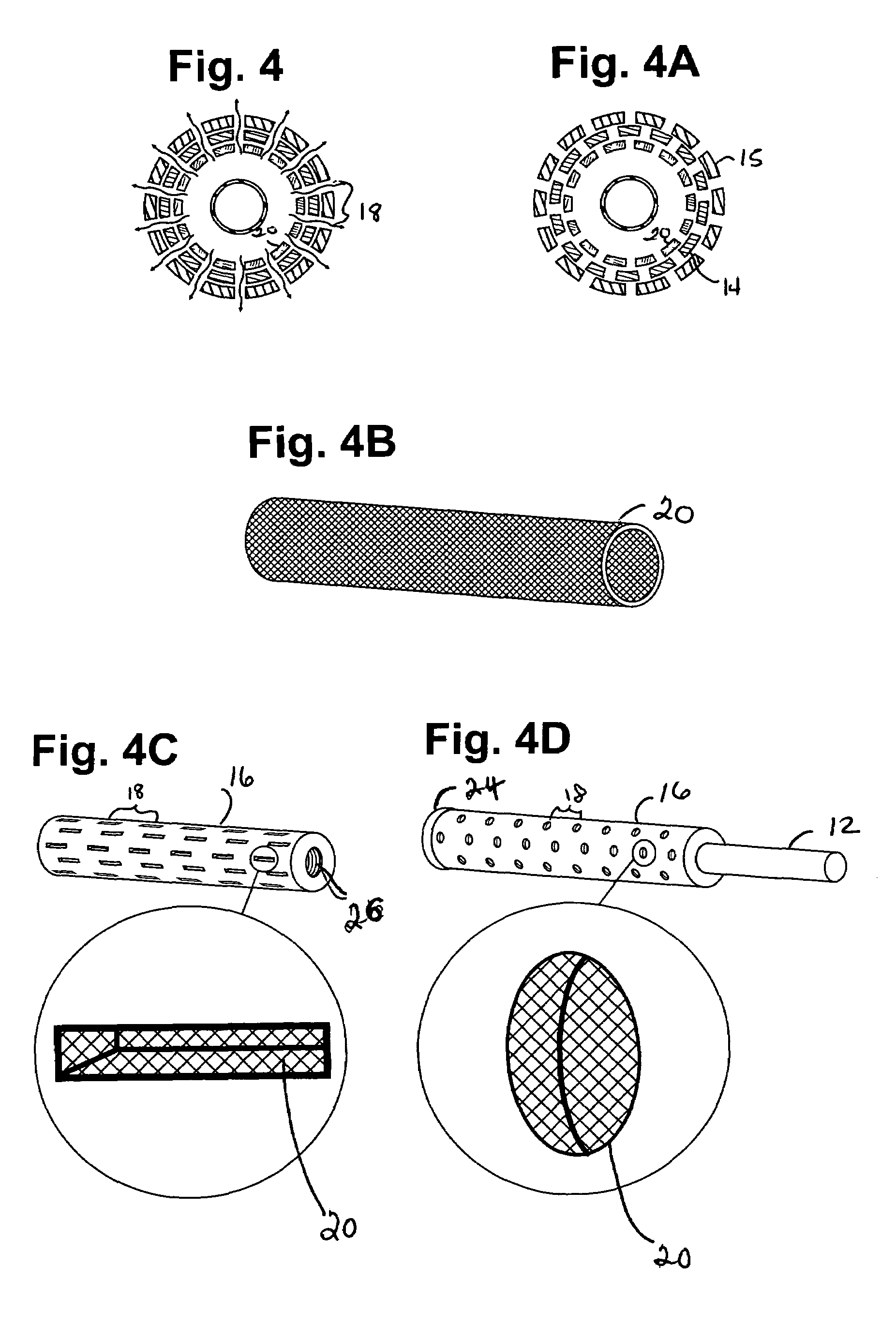 Surface treatment articles and methods