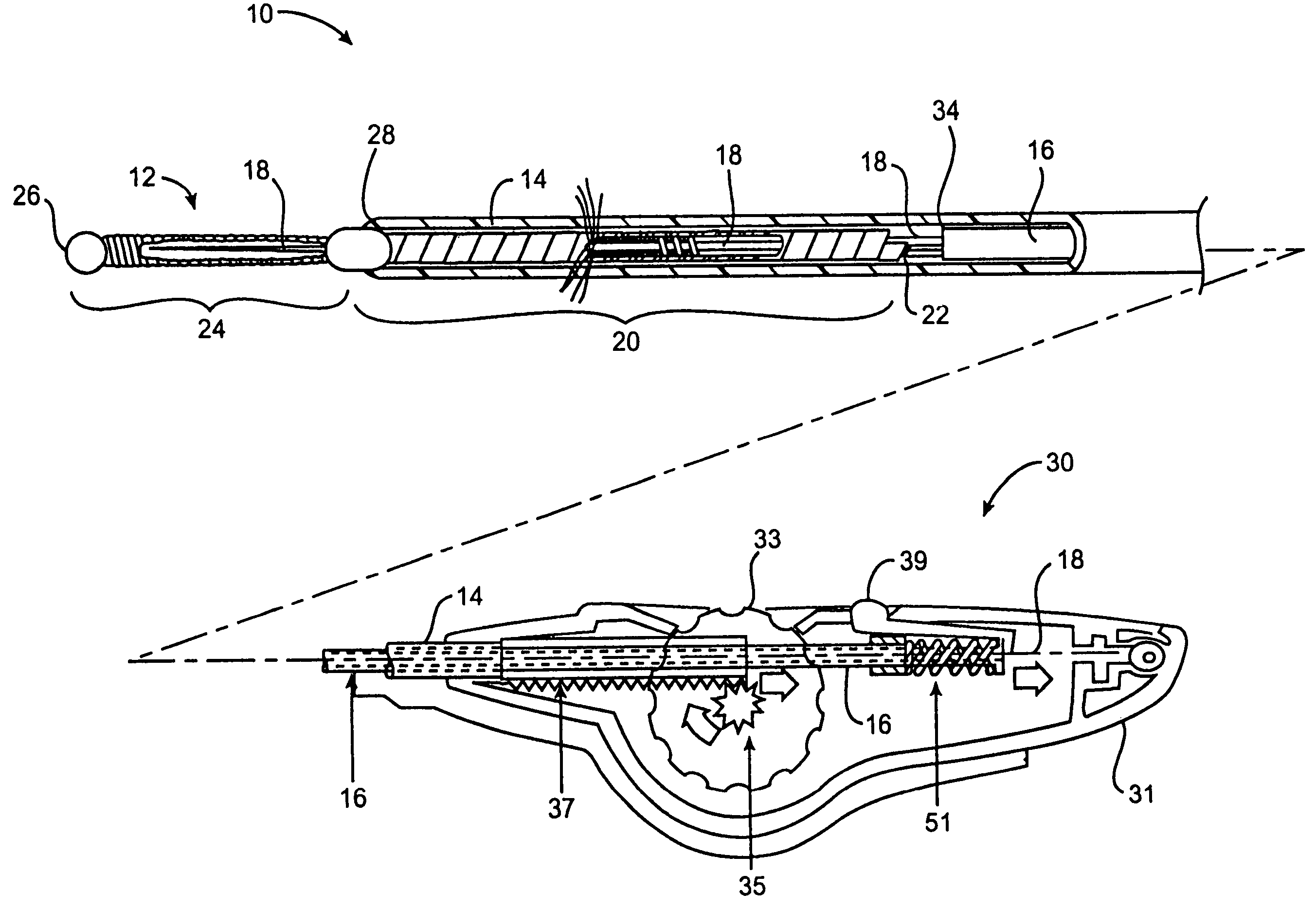 Deployment actuation system for intrafallopian contraception