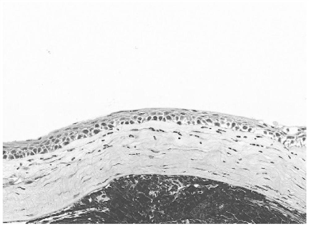 Cornea repair hydrogel and preparation method and application thereof