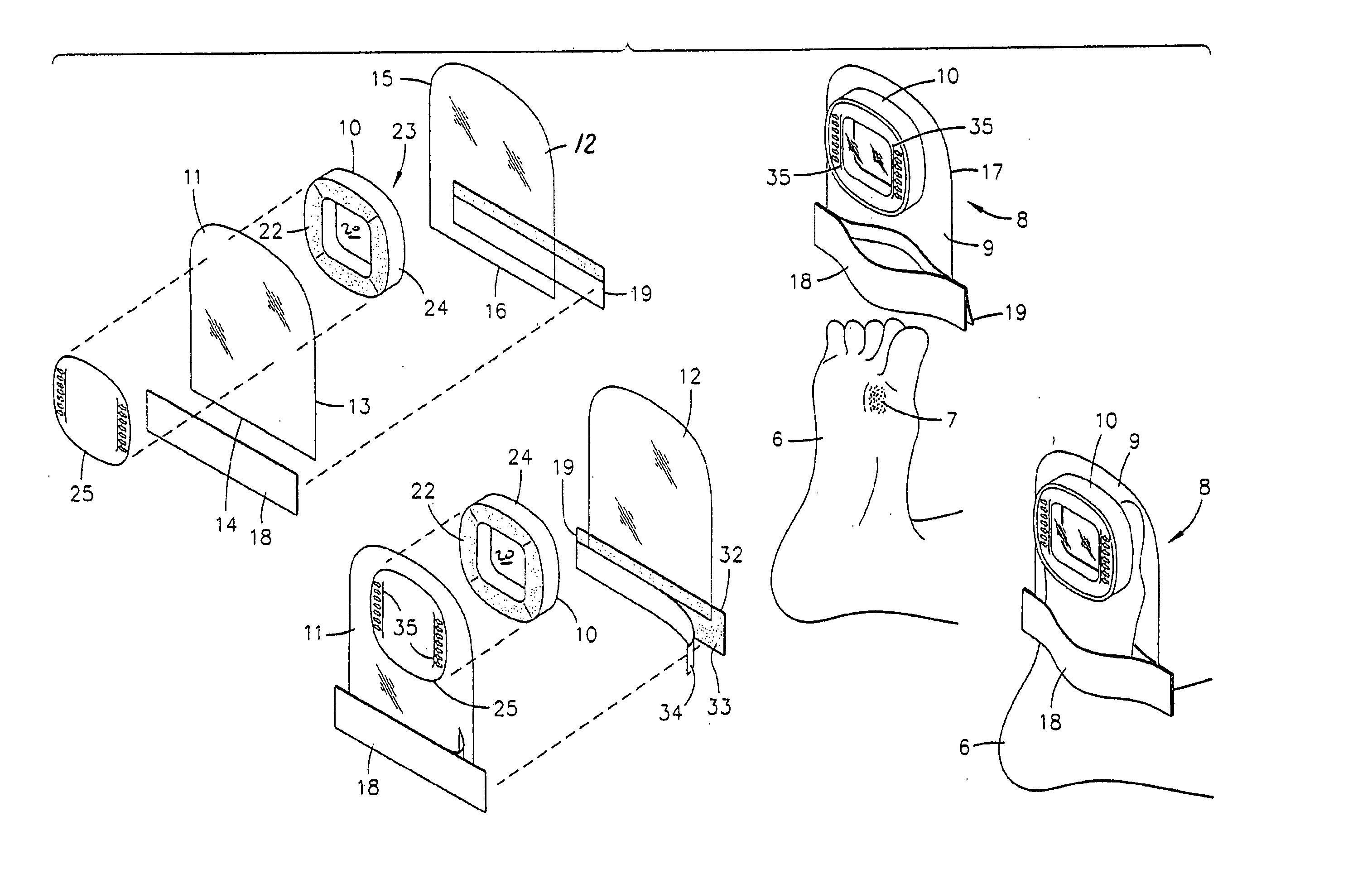 Tissue treatment device for an extremity