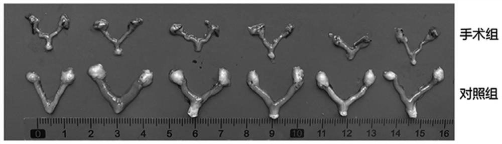 Construction method of improved mouse ovariectomy operation model