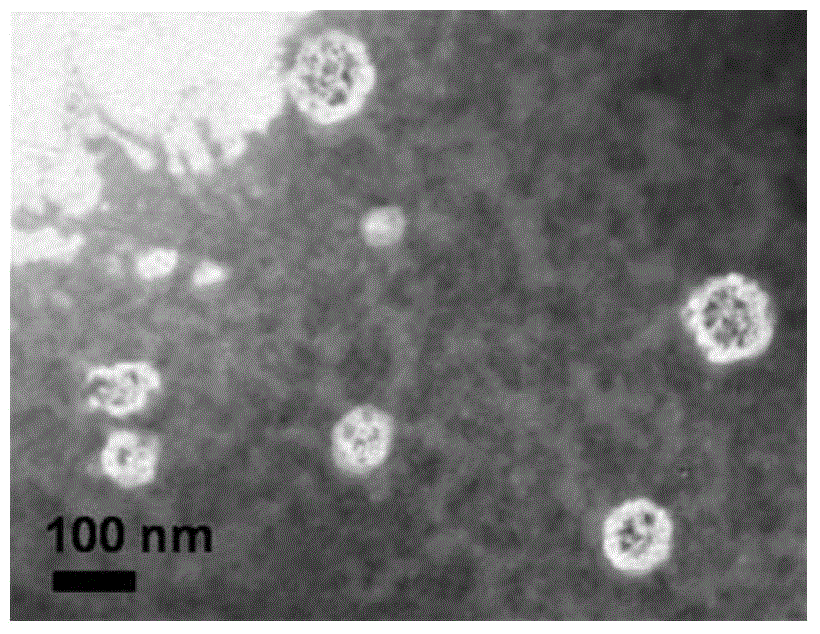 Targeted polymer micelle magnetic nanoparticle, and preparation method and application thereof