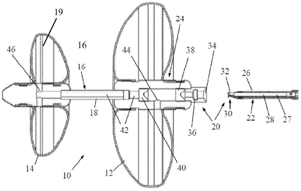 Inflatable obstruction device for the pyloric sphincter