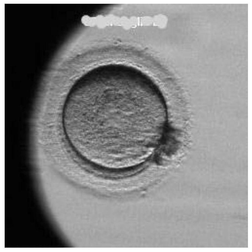 A device for predicting embryo pregnancy outcome based on segmented sampling video features