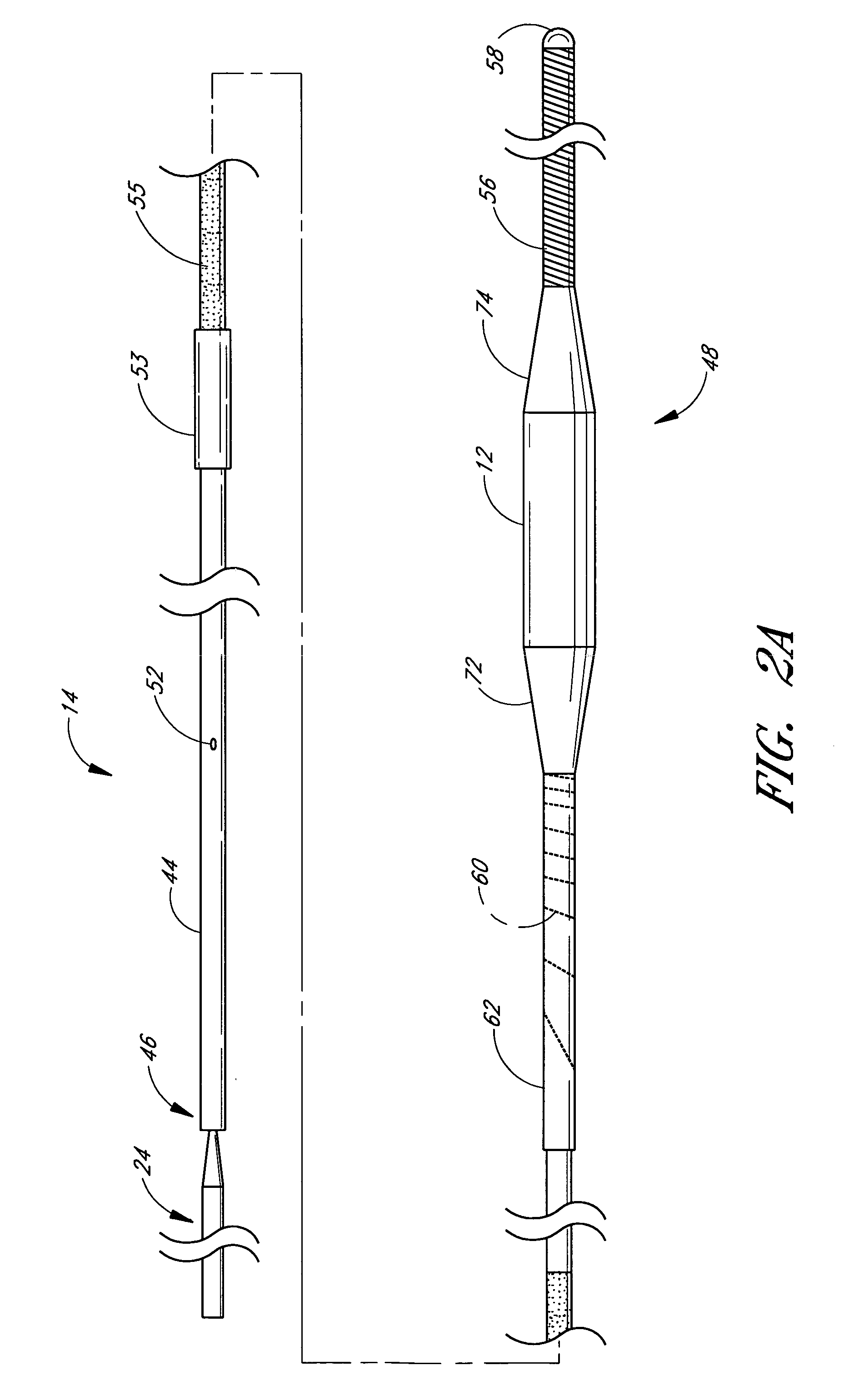 Method and apparatuses for treating an intravascular occlusion