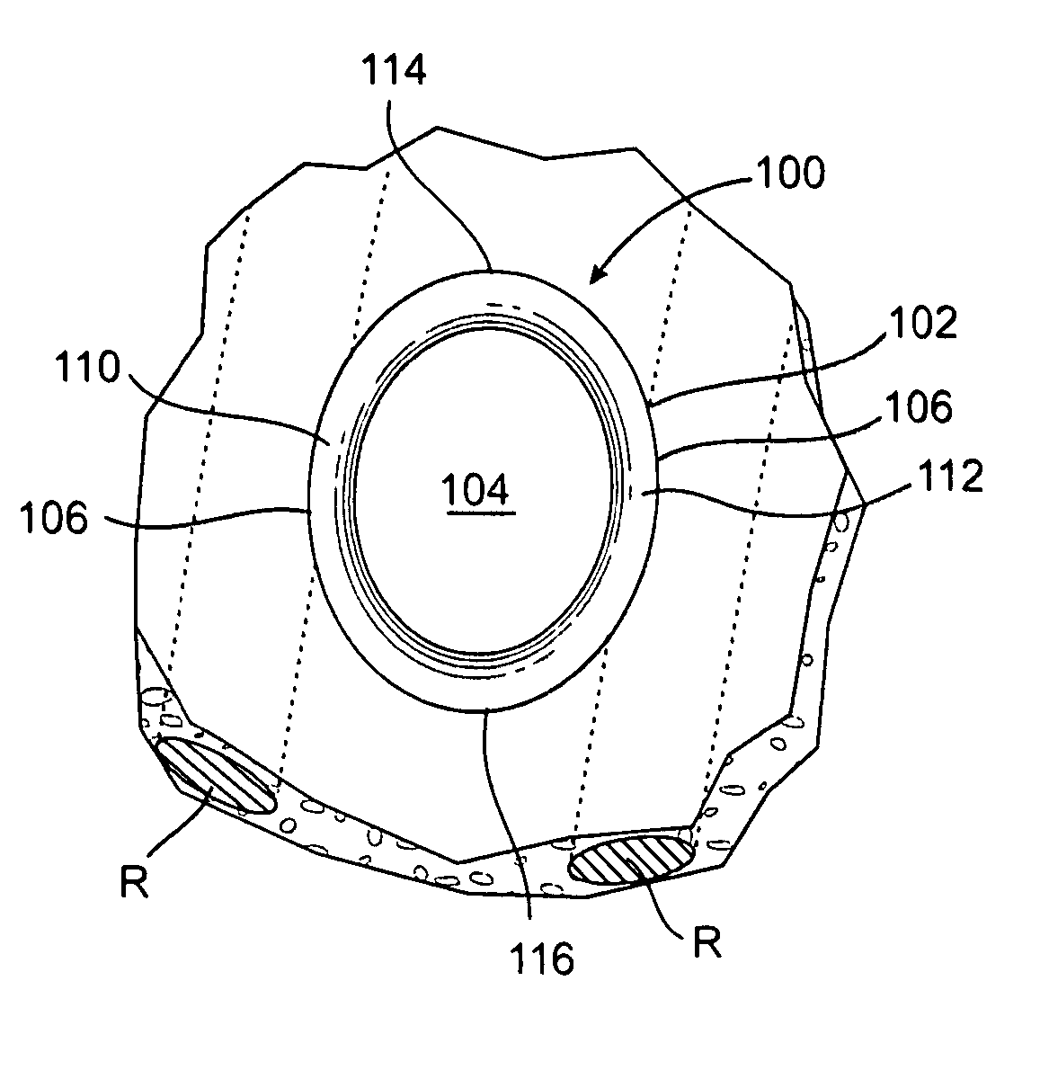 Retractor with inflatable blades