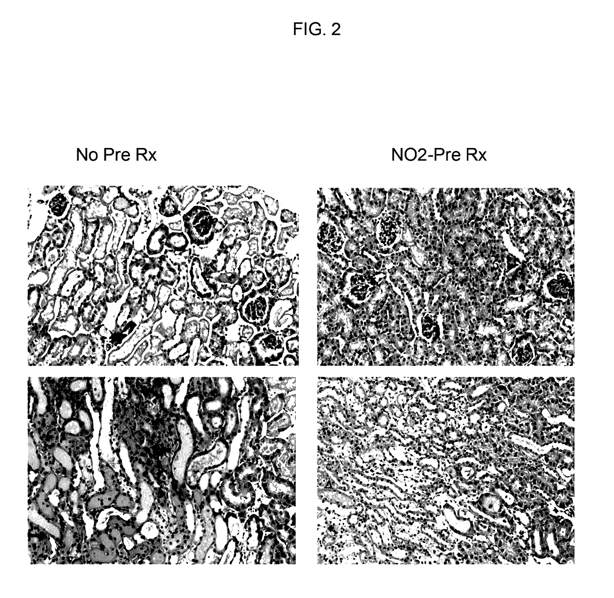 Compositions, kits, and methods to induce acquired cytoresistance using stress protein inducers