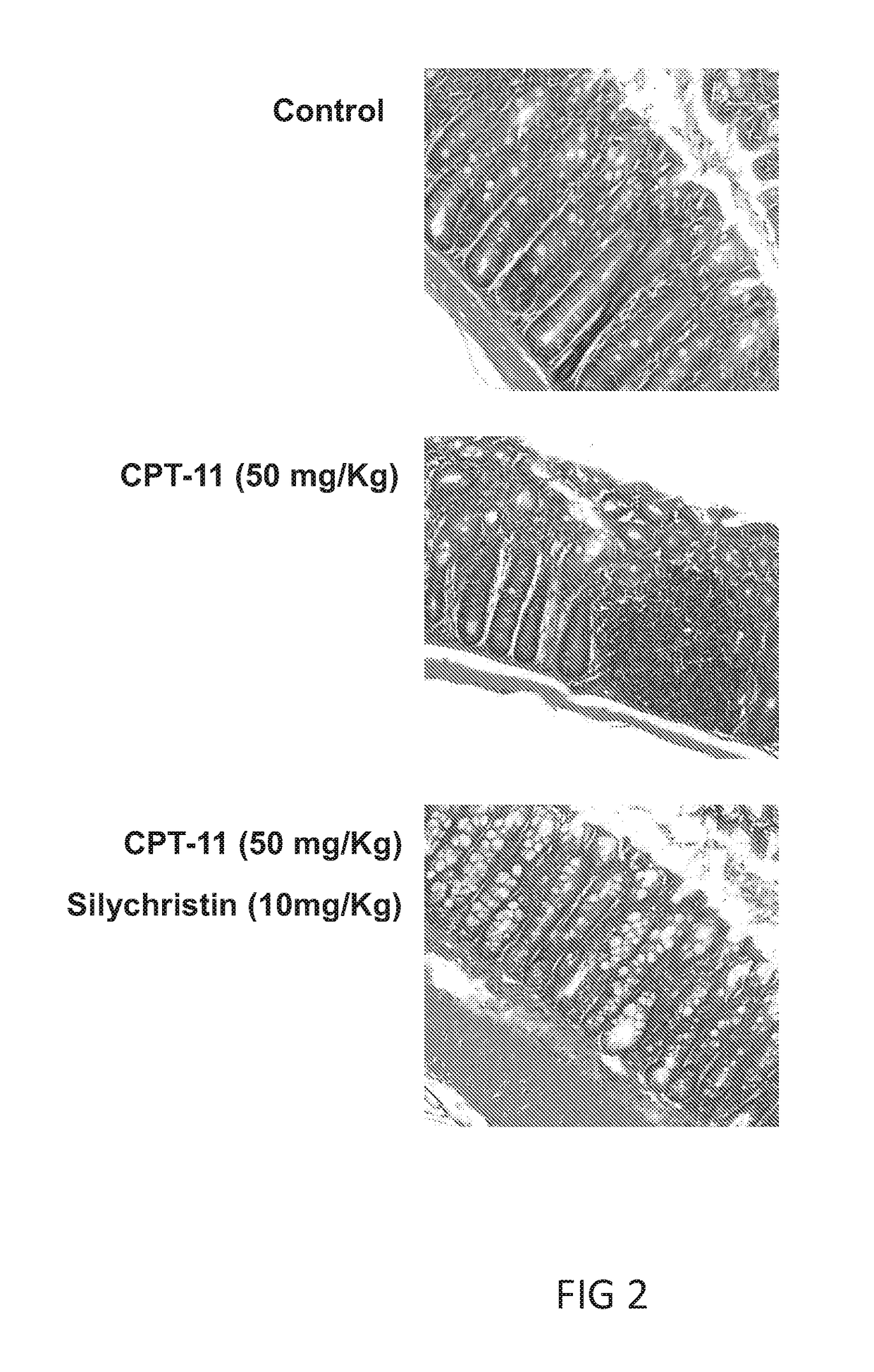 Methods and formulation for improving oral availability of cpt-11 while reducing cpt-11 induced gastrointestinal toxicity in cancer therapy