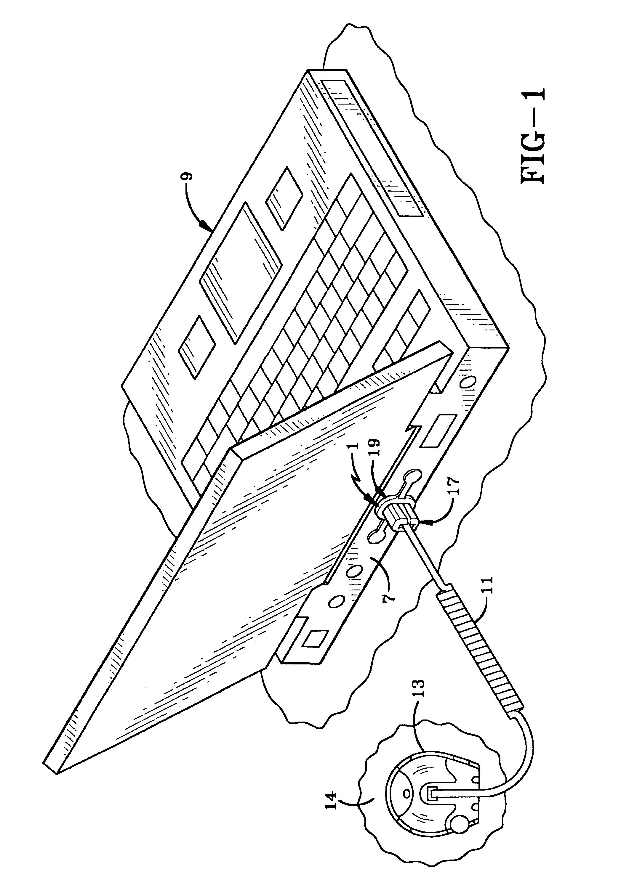 Cable attachment device