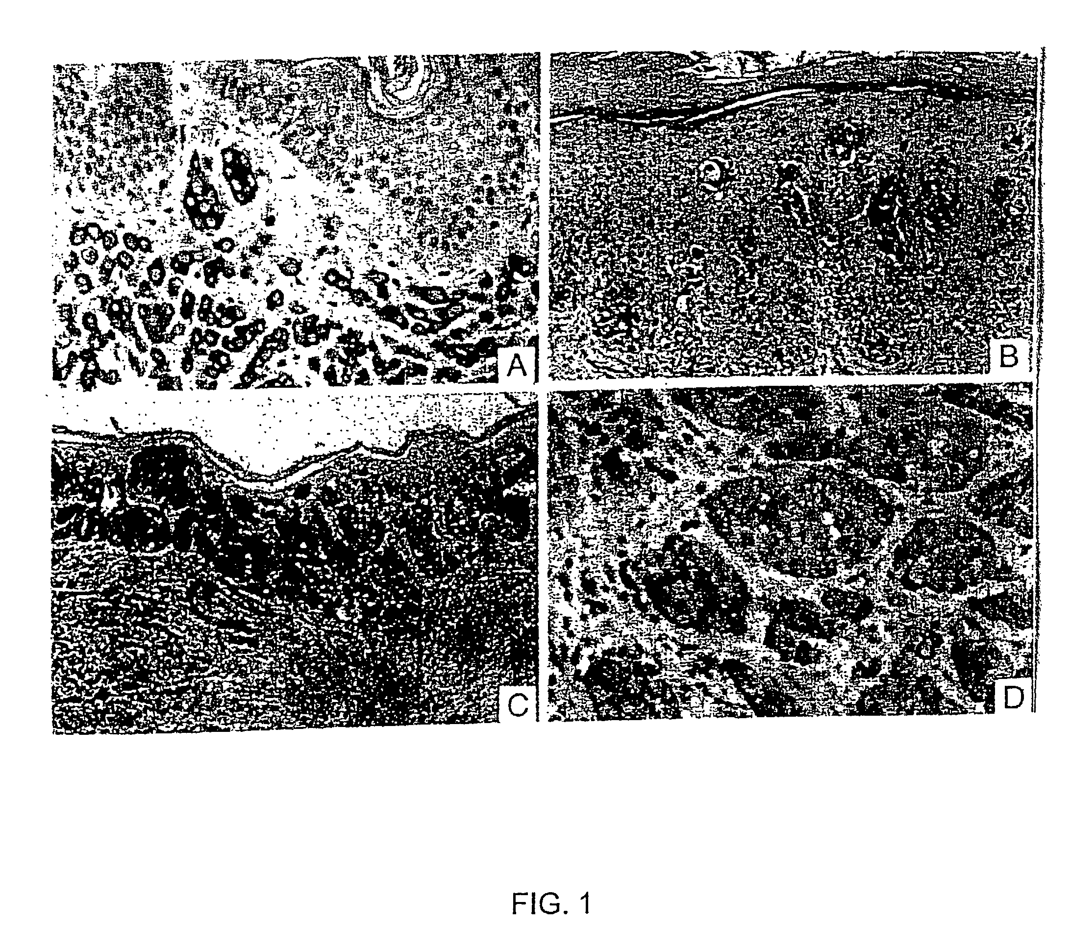 Method and composition for diagnosis of melanocytic lesions
