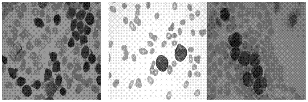 A method for aml cell segmentation based on meanshift clustering and morphological operations