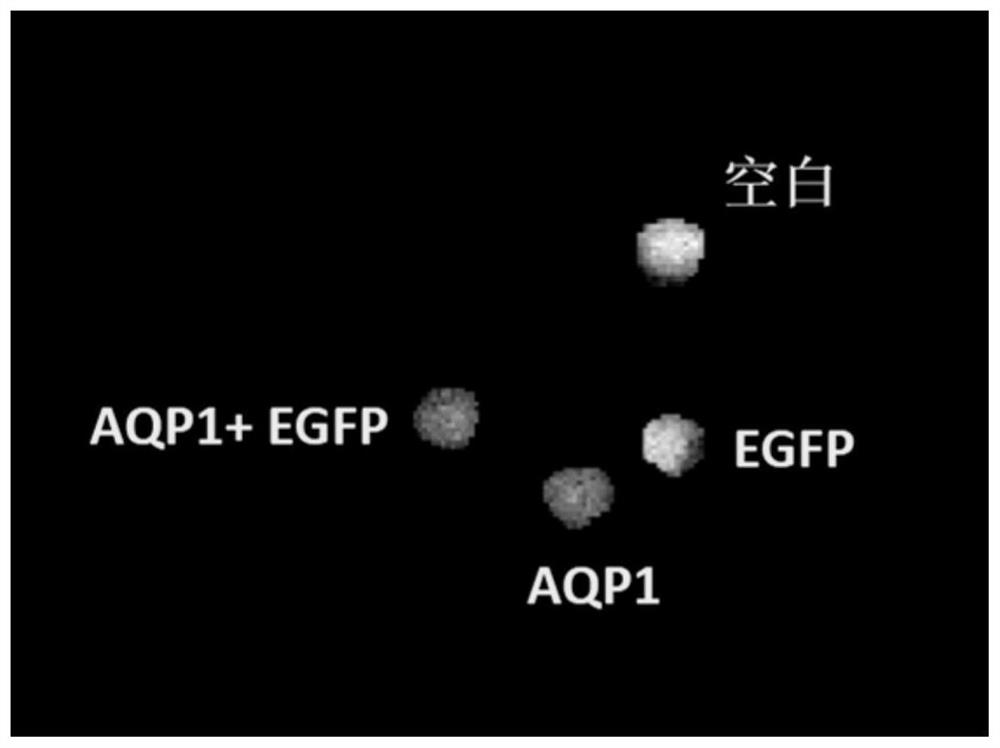 Adeno-associated virus capable of being used for bimodal imaging and application of adeno-associated virus