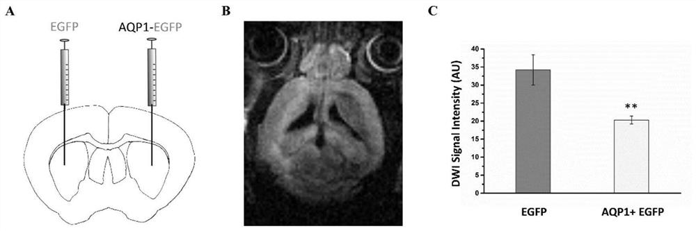 Adeno-associated virus capable of being used for bimodal imaging and application of adeno-associated virus