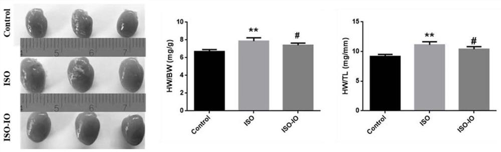 Application of inonotus obliquus in preparation of medicine for resisting ventricular remodeling