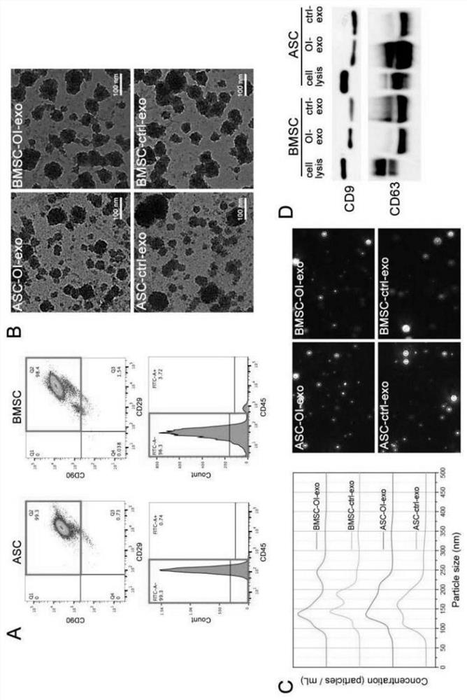 Multistage micro-nano structure bone repair scaffold for freeze-drying delivery of exosome