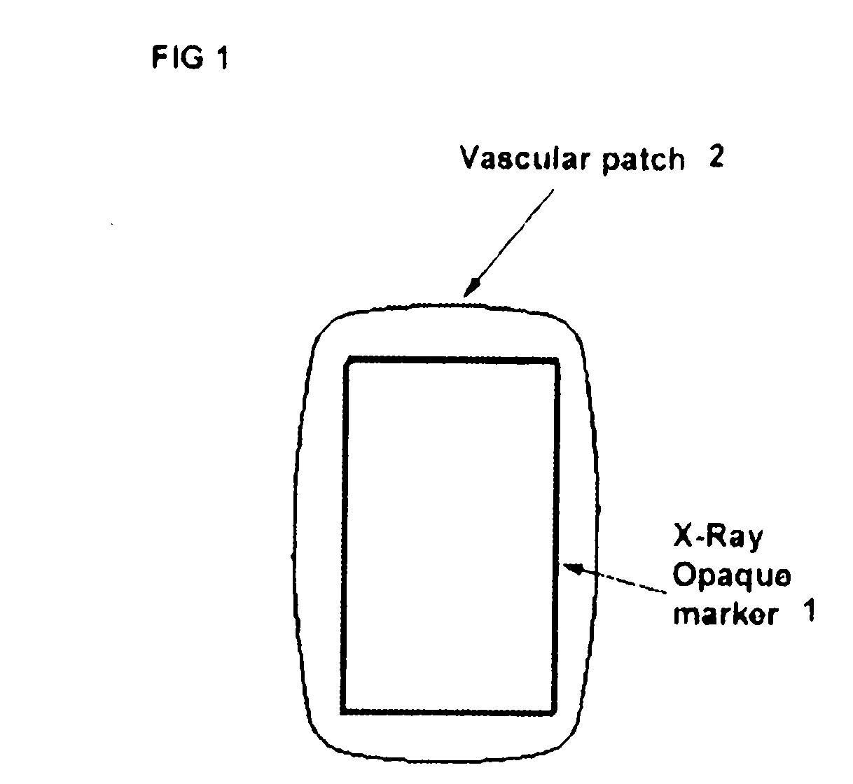 Labeled vascular patch