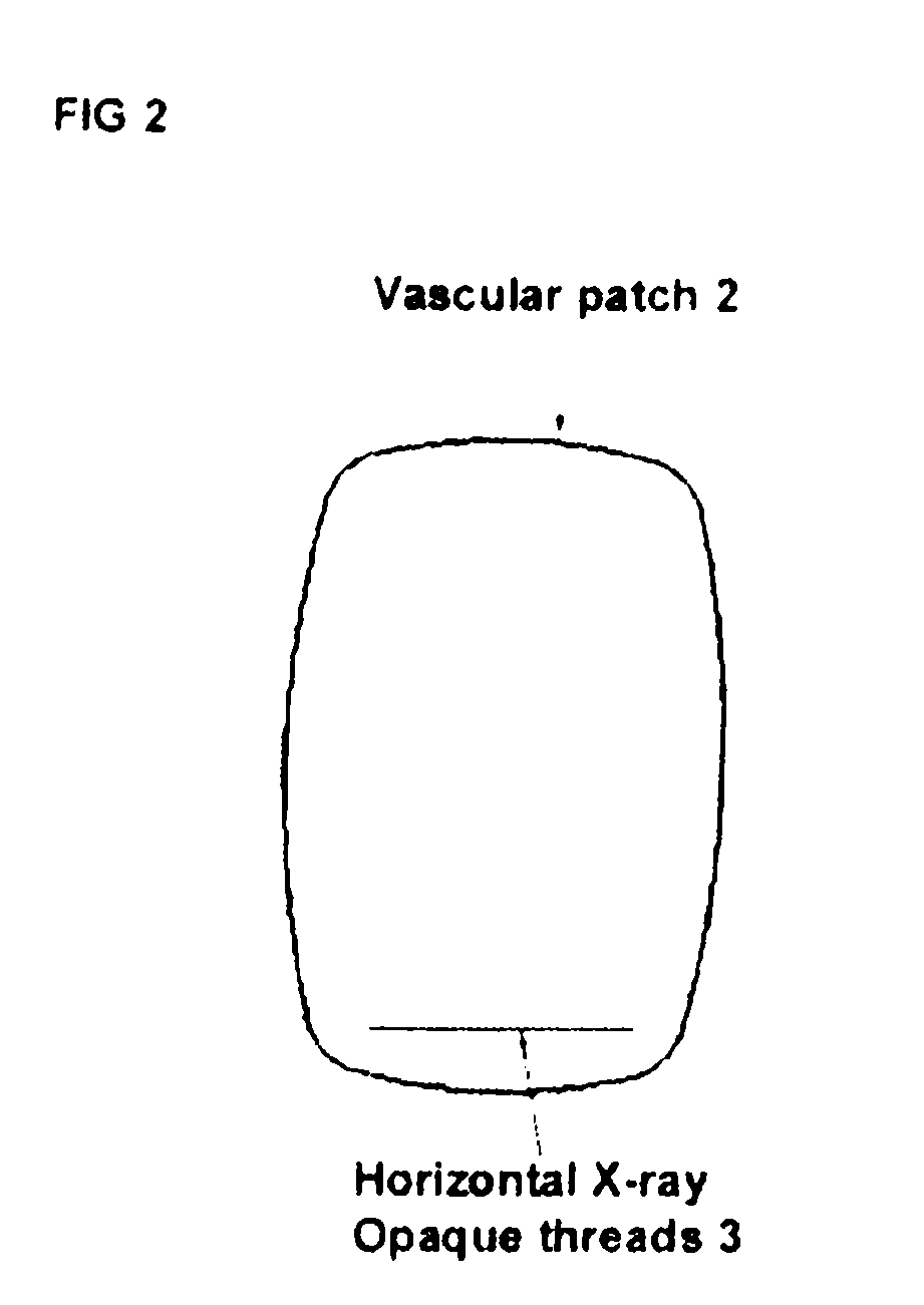 Labeled vascular patch