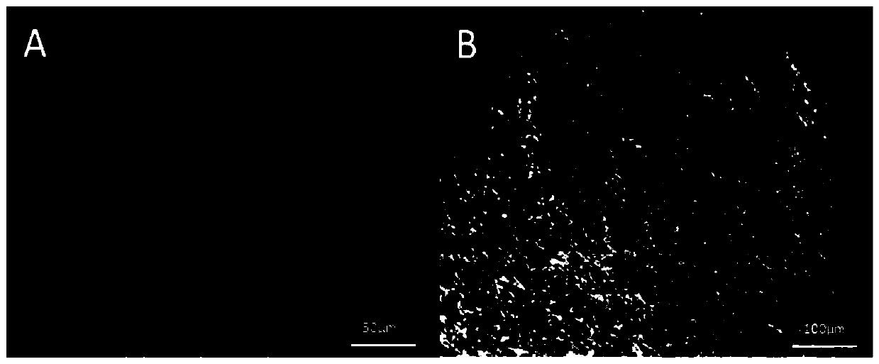 A polylactic acid/hydroxyapatite/acellular amnion composite scaffold and its construction method