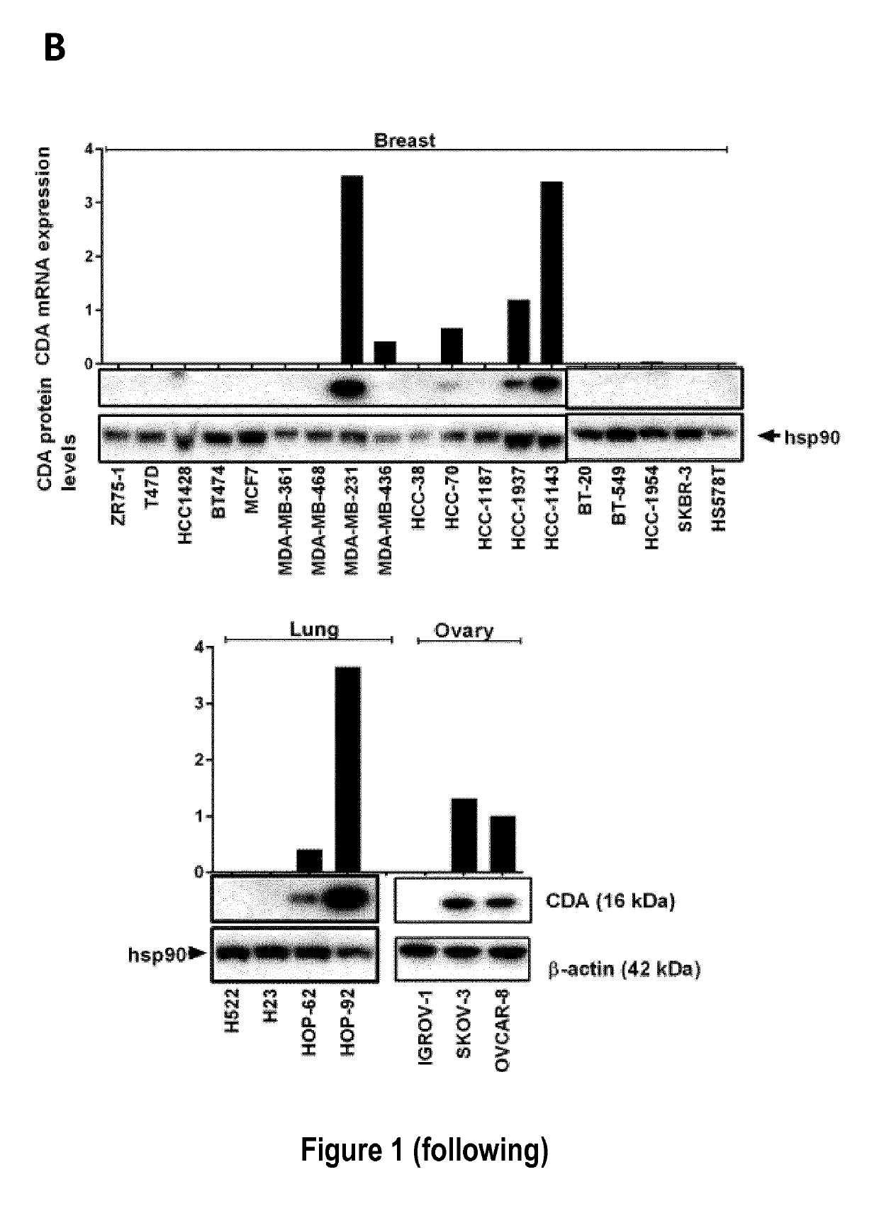 Cytidine deaminase expression level in cancer as a new therapeutic target