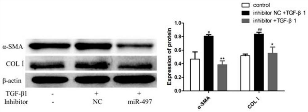A kind of inhibitor of mir-497-5p and its application in the preparation of medicine for treating liver fibrosis