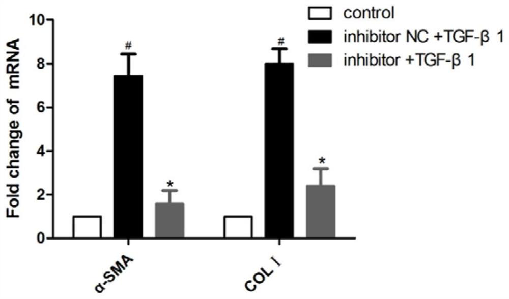 A kind of inhibitor of mir-497-5p and its application in the preparation of medicine for treating liver fibrosis