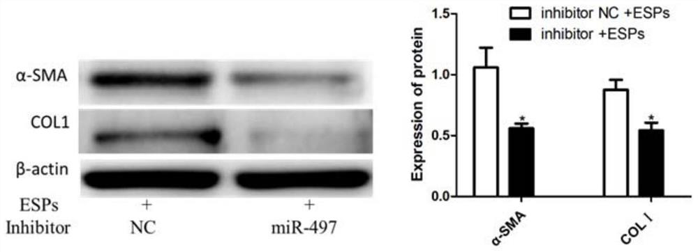 A kind of inhibitor of mir-497-5p and its application in the preparation of medicine for treating liver fibrosis