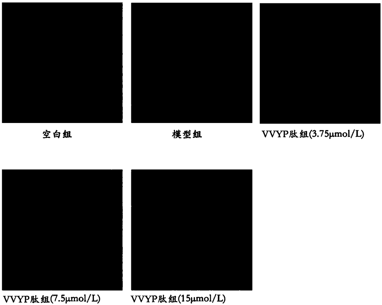 Application of VVYP peptide or salt thereof in preparing medicine for preventing or treating non-alcoholic fatty liver disease